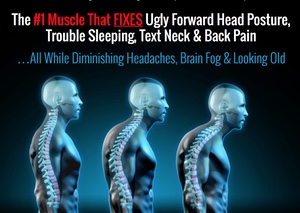 Forward Head Posture Fix – How To Get Rid Of a Headache Tips